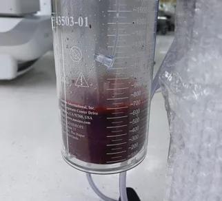 支气管动脉栓塞最严重术后并发症,支气管扩张并咯血的介入栓塞治疗