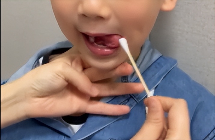 孤独症儿童口语提要求,孤独症孩子语言训练技巧