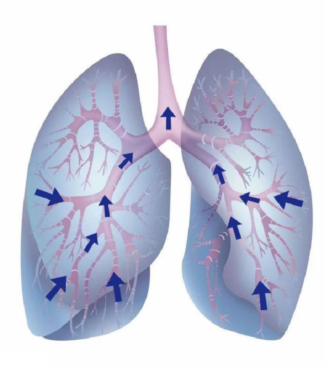 痰液粘稠难以咳出用什么方法排痰,痰液多咳不出来怎么办