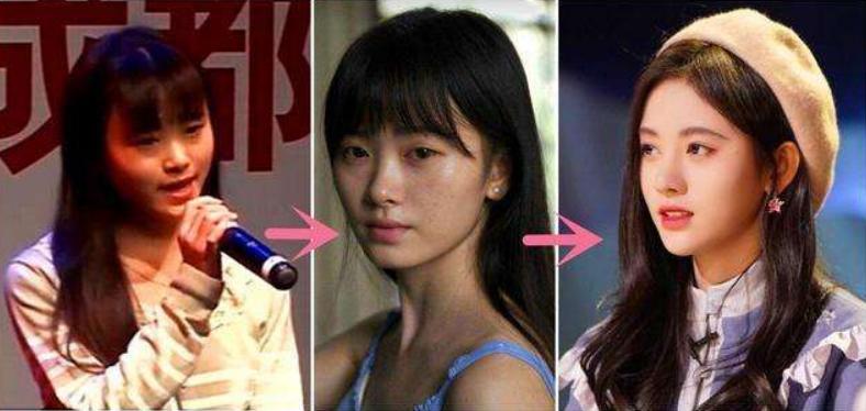 盘点整容失败惨不忍睹的30位女星,那些整容整失败的女明星