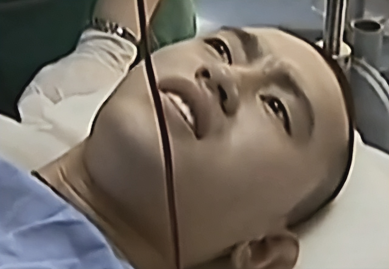 男子意外烧伤用蛆来治疗后续,小伙双腿被烧伤医生用蛆治疗