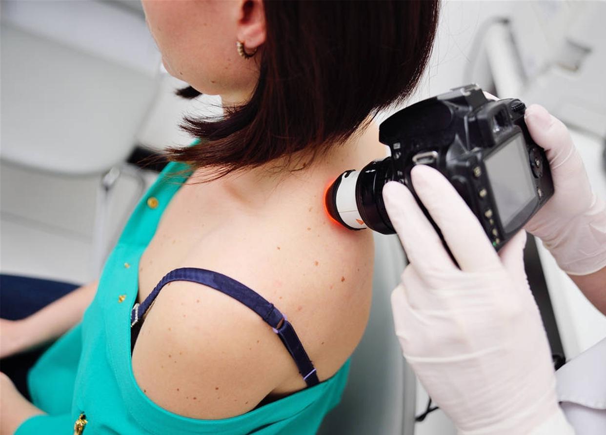 小孩痣长在什么地方代表什么,孩子身上的痣真的能预示未来