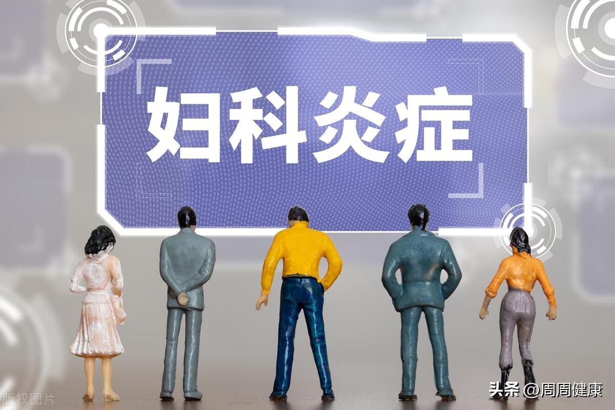 霉菌性阴道炎的症状和治疗方法,男性感染霉菌性阴道炎有什么症状