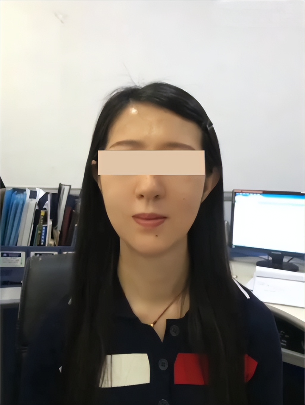 轮廓线打造和吸脂,面部轮廓线吸脂