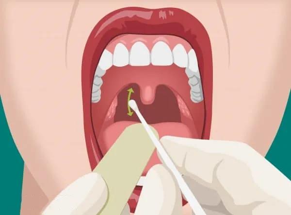 口咽、鼻咽拭子采集标准