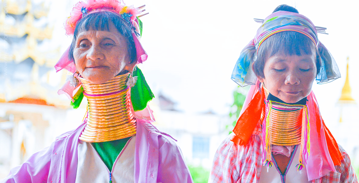 以脖子长为美的民族，脖子上戴满重铜环，一生只有3次机会取下