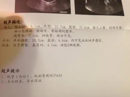 孕中期查出羊水浑浊怎么办,孕妈妈做b超检查是双胞胎