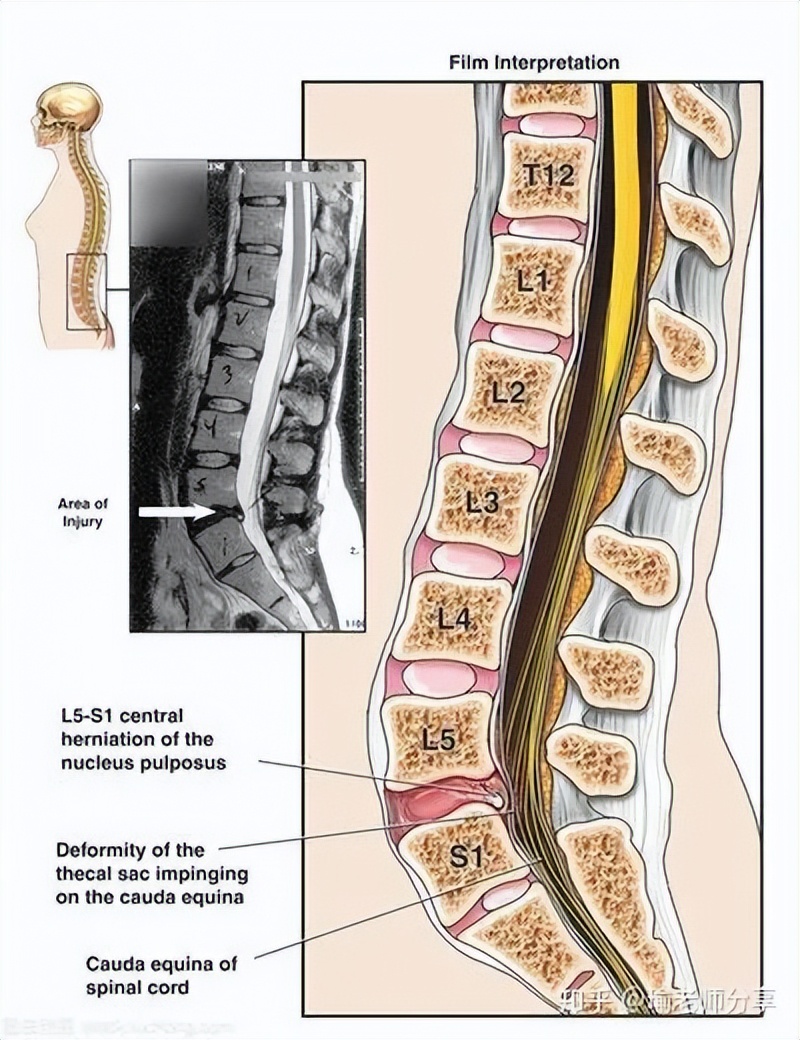 腹压式呼吸教学,腹压呼吸什么好处