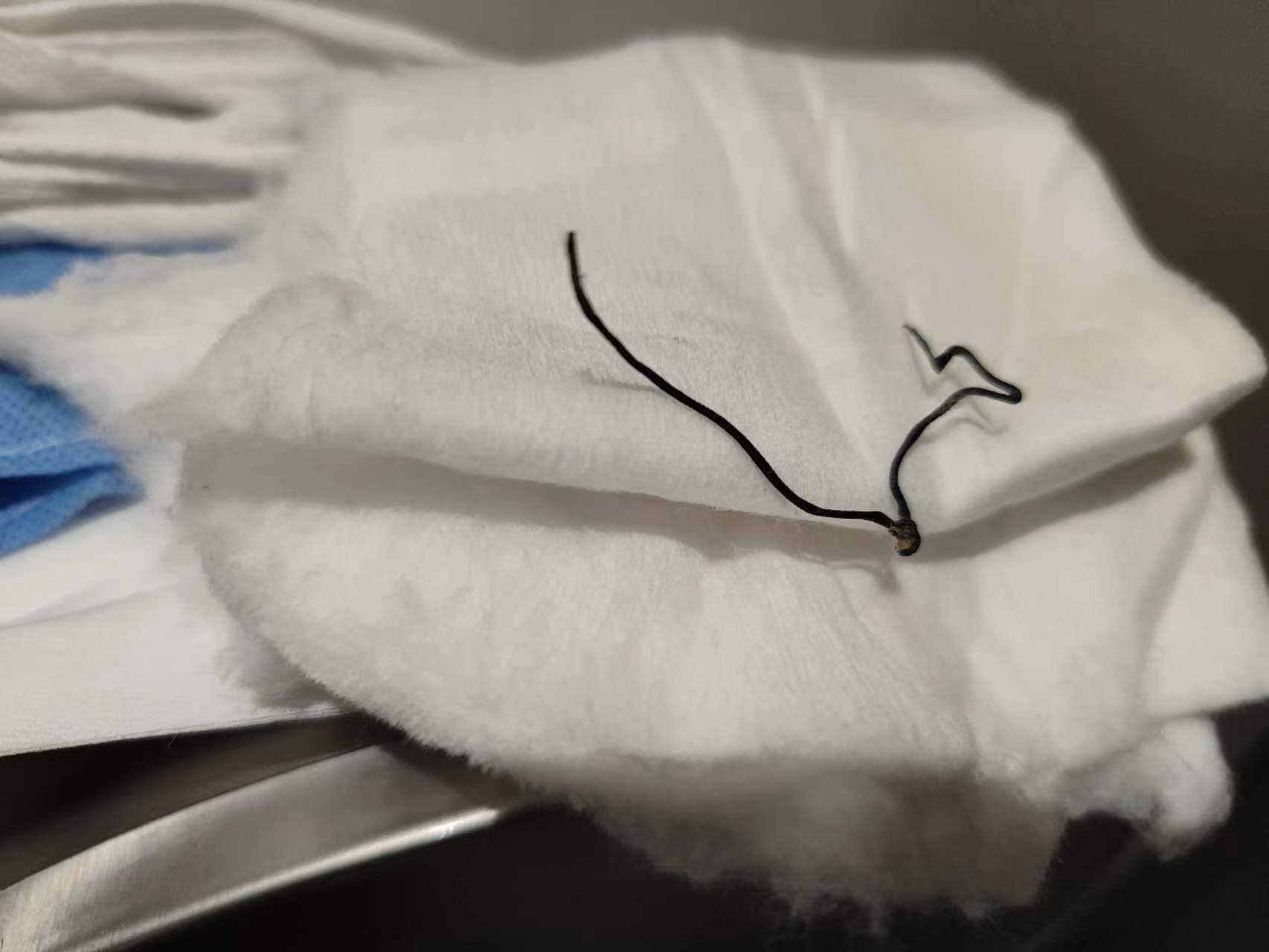 痔疮手术后60天亲身经历,痔疮手术20天亲身经历