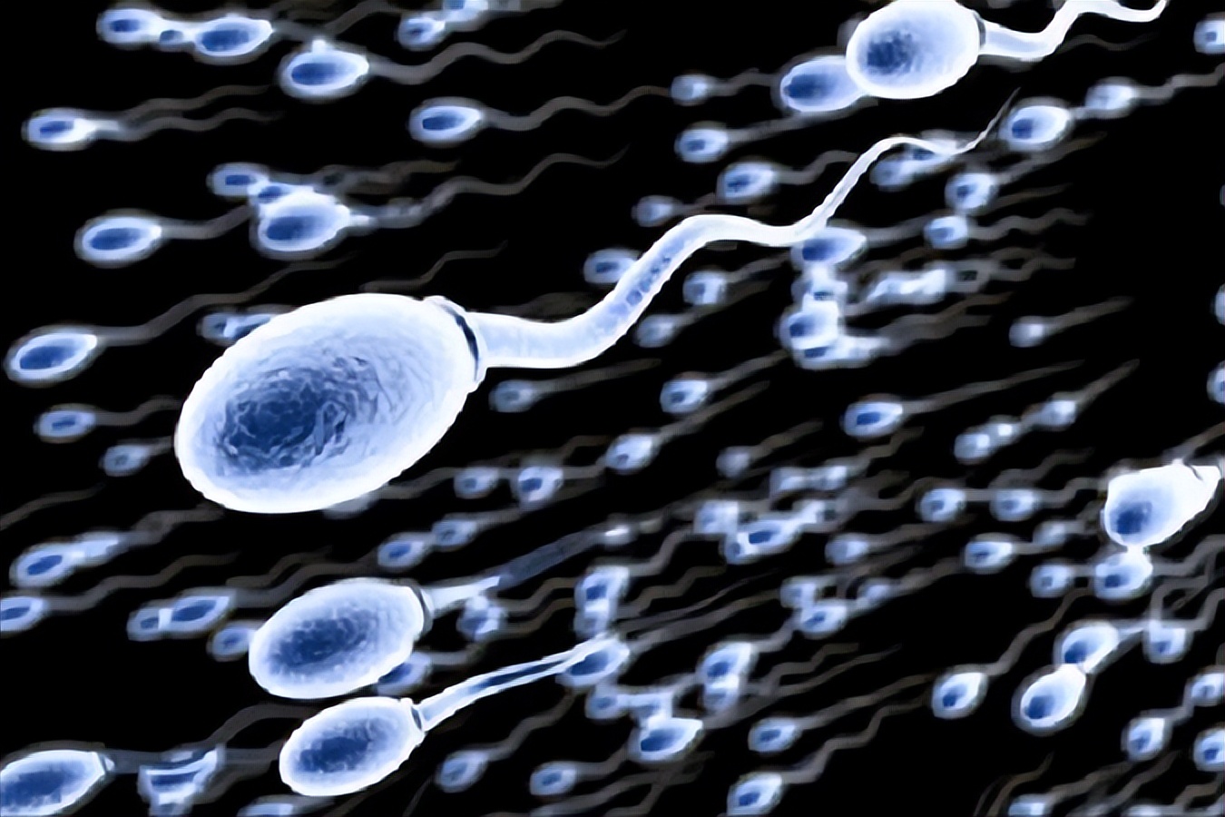 精子变黄什么原因引起的,精子变黄的病因