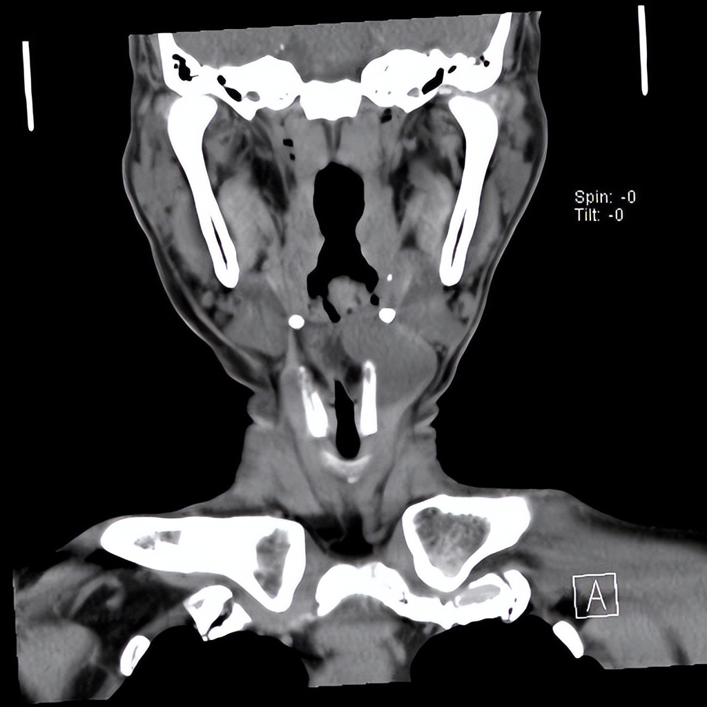 颈部有肿块不痛不痒严重吗,颈部肿物恶性的可能大吗