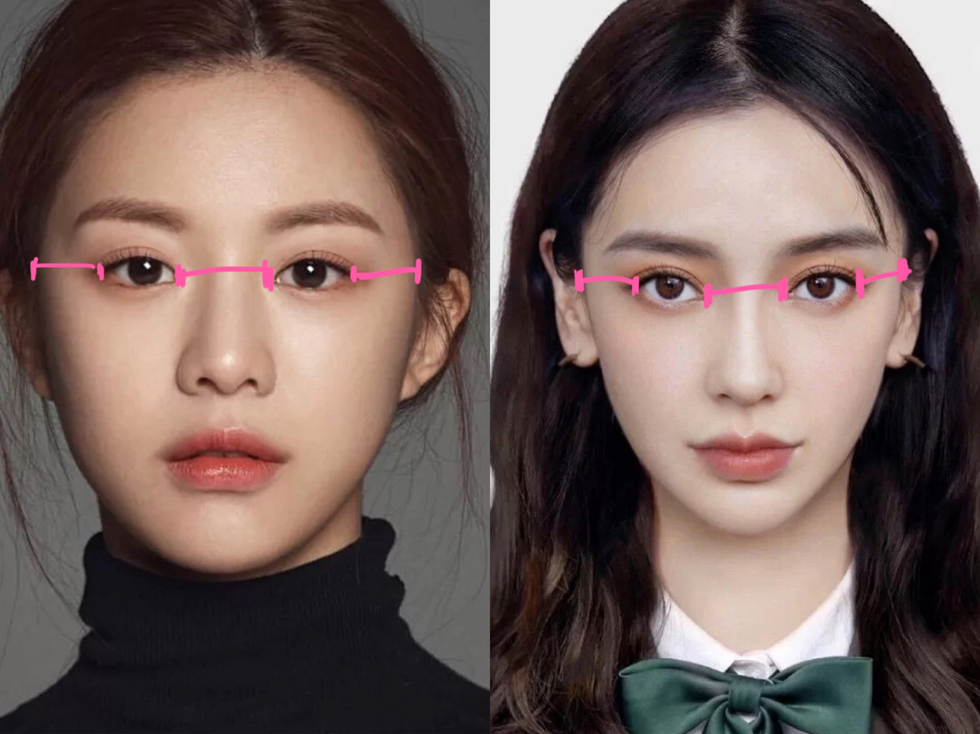 整形科普知识修复双眼皮,双眼皮整形有哪些常见方法