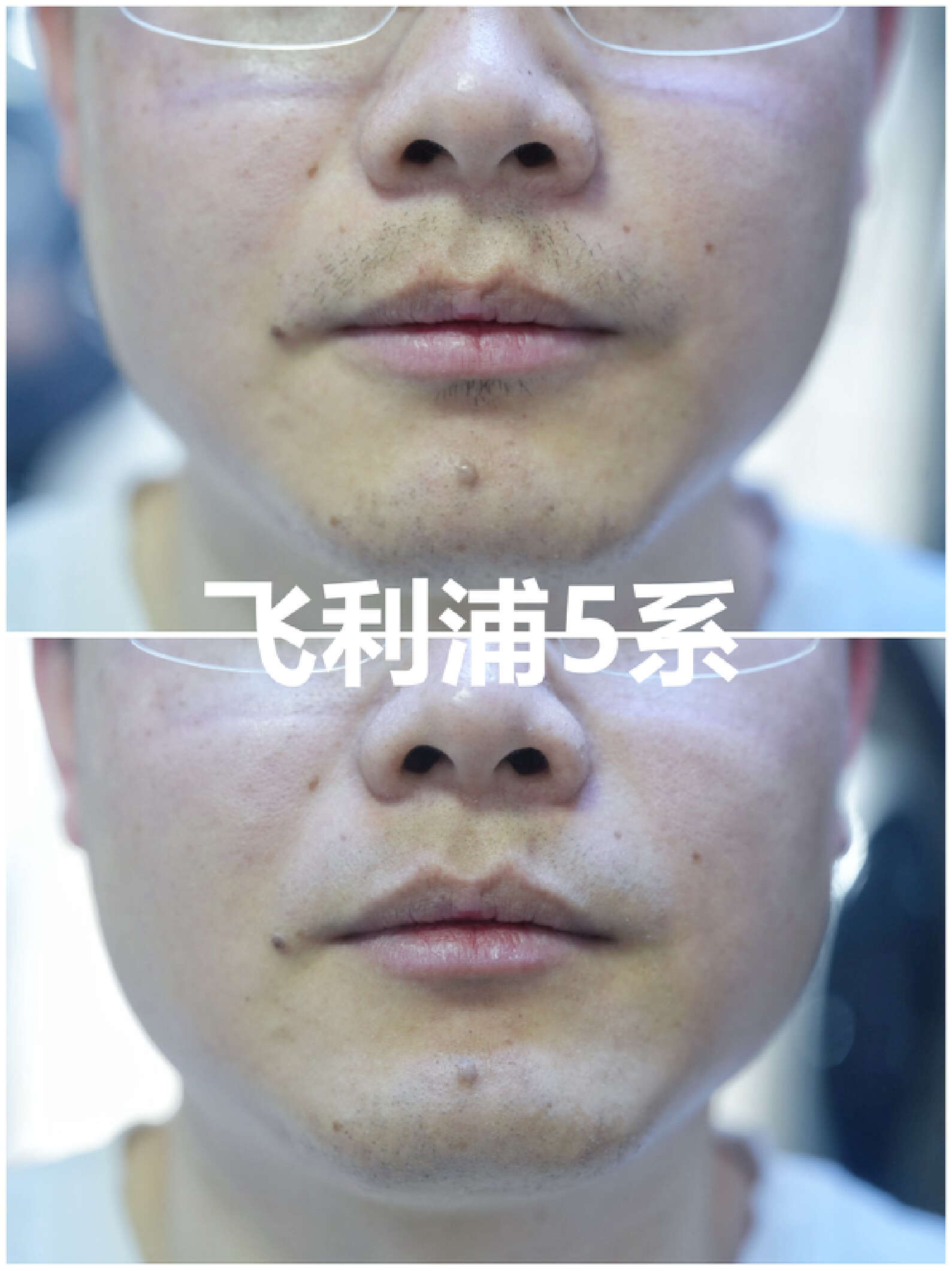 博朗剃须刀9557对比飞利浦9860,中国剃须刀比飞利浦博朗松下都强