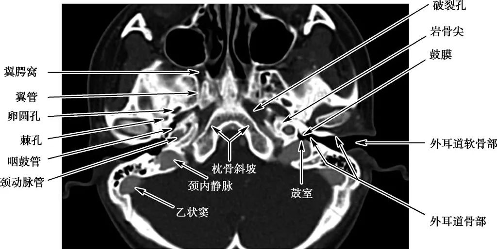 耳部解剖结构和生理功能,耳部解剖笔记