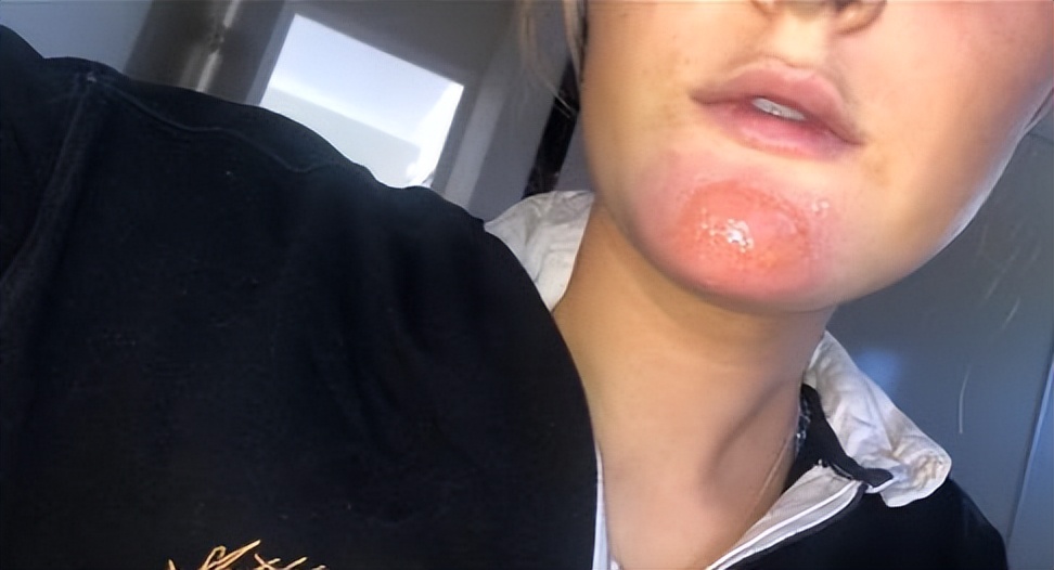 澳洲妹子和男友接吻,澳大利亚女子与男友接吻