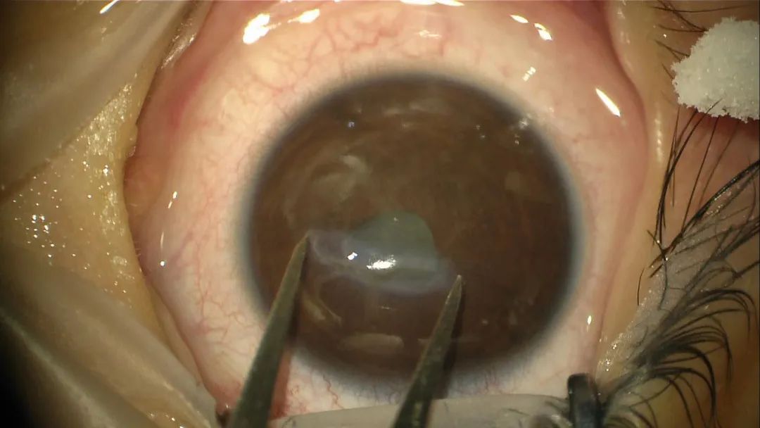 临沂妇幼保健院危急值,临沂市妇幼保健院儿童重症监护室