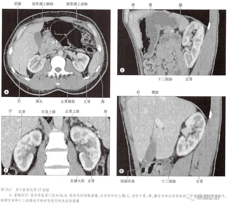 输尿管和髂血管解剖,脾胰解剖图