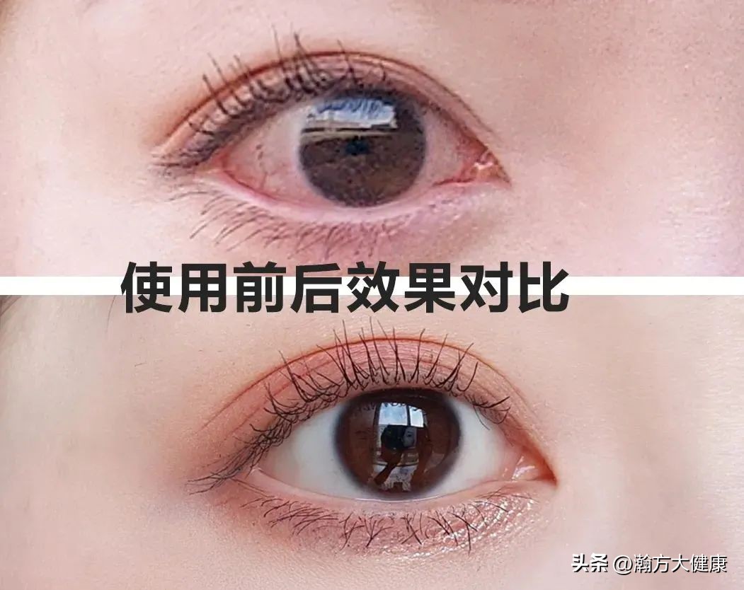 眼睛干涩疲劳滴了眼药水,眼睛干涩疲劳模糊滴眼液