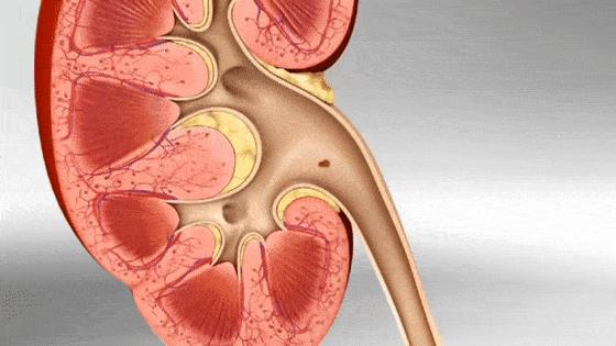 出现血尿并伴有腰疼什么原因,结石血尿腰痛怎么办啊