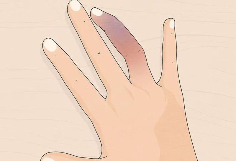 手指骨折和脚踝骨折哪个难受,手腕骨折和脚踝骨折哪个严重