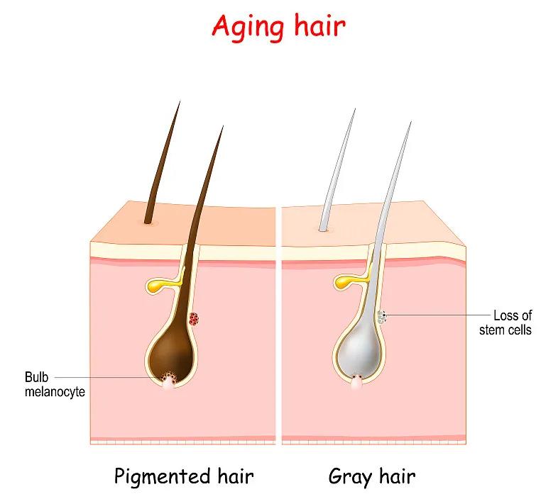 白发应该吃什么食物才会变黑,有白发吃啥会使头发变黑