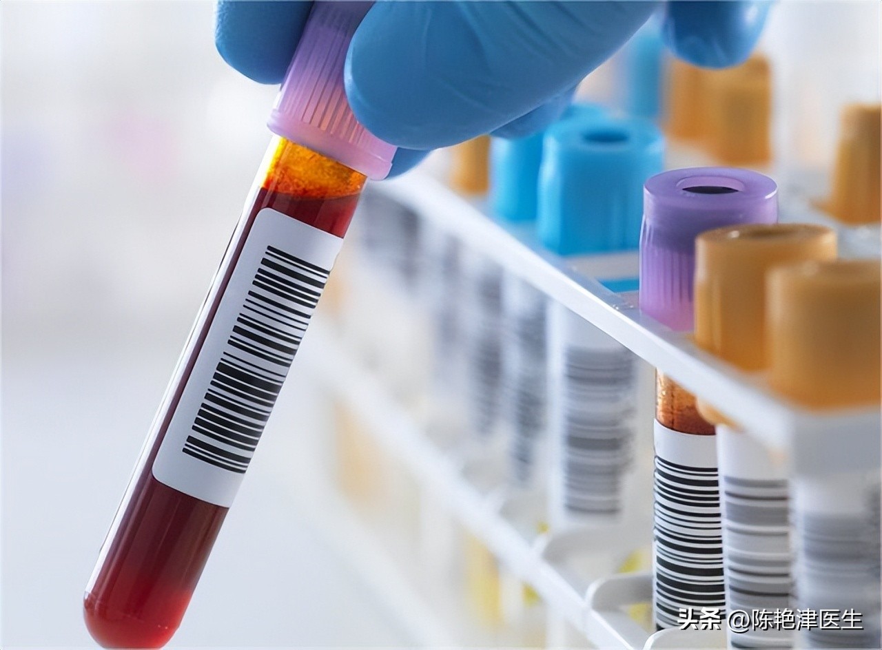 体检查出肾结石怎么办？医生：2个方法，或能让肾结石离开身体