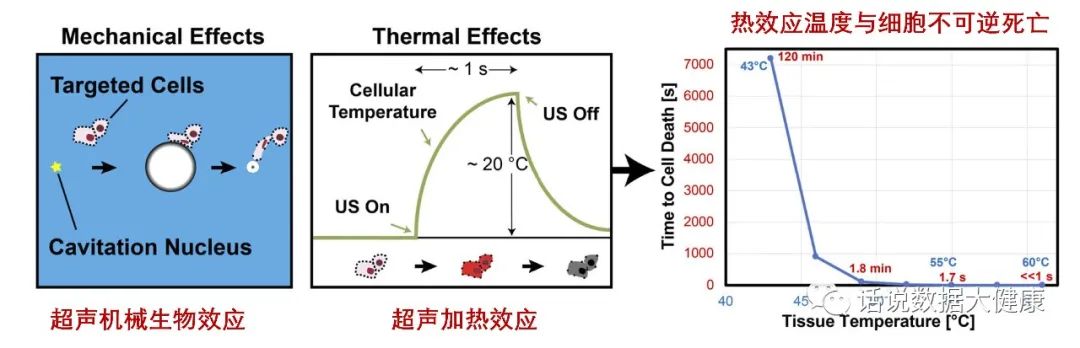 超声减脂注意事项,激光减脂和射频减脂的区别