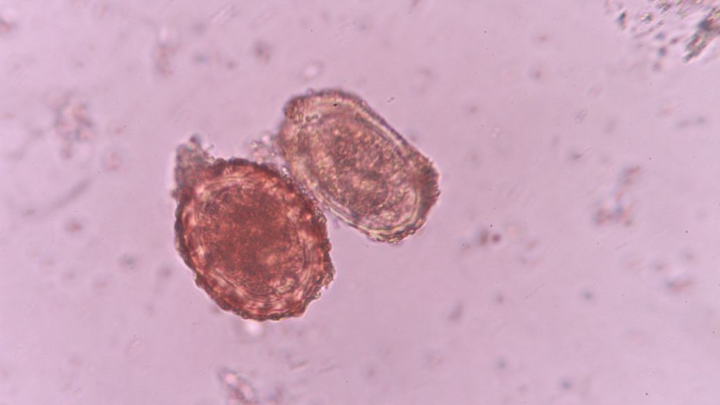 猪球虫病症状和治疗方案,猪球虫病的诊断