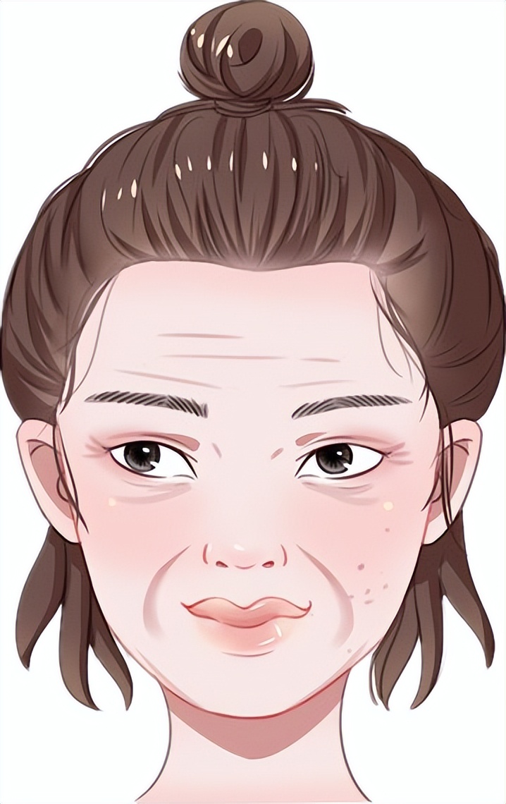 皱纹怎么消除最快方法,皱纹怎么快速消除用什么方法