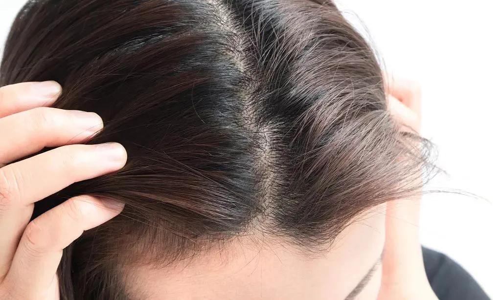 发量少发际线高减龄适合什么发型,发量少发际线后移适合什么短发