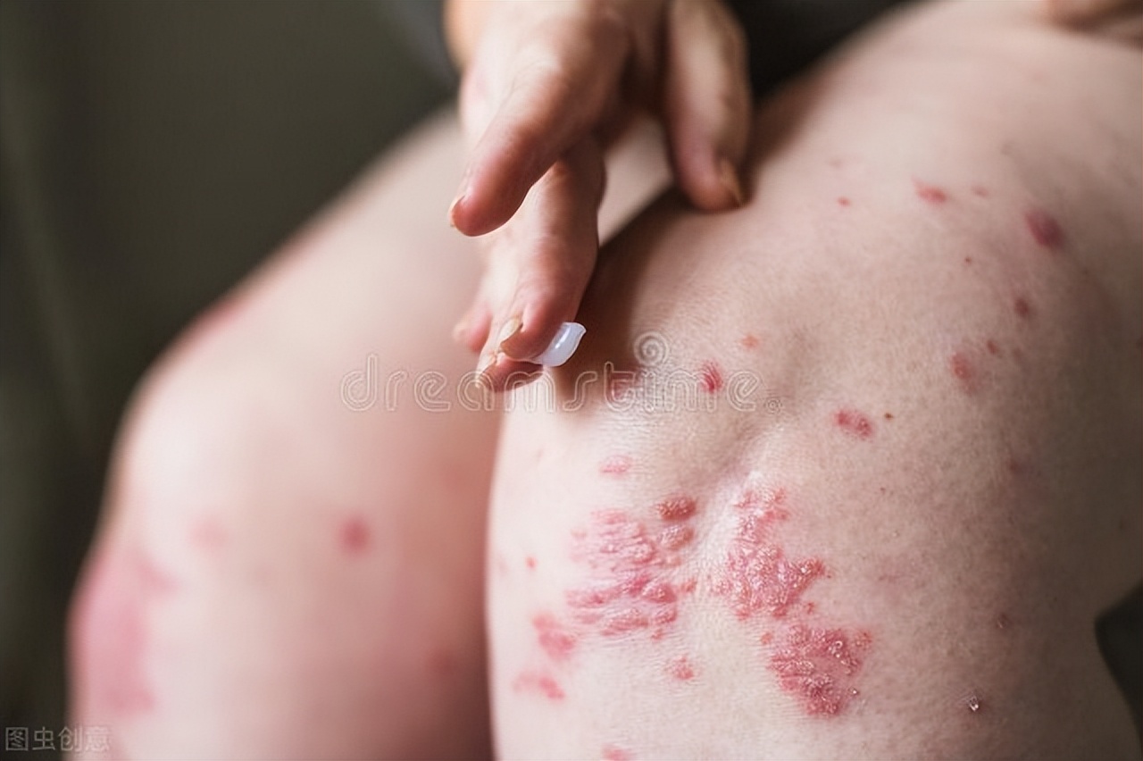 你的皮肤哪里出了问题,你的皮肤问题有哪些