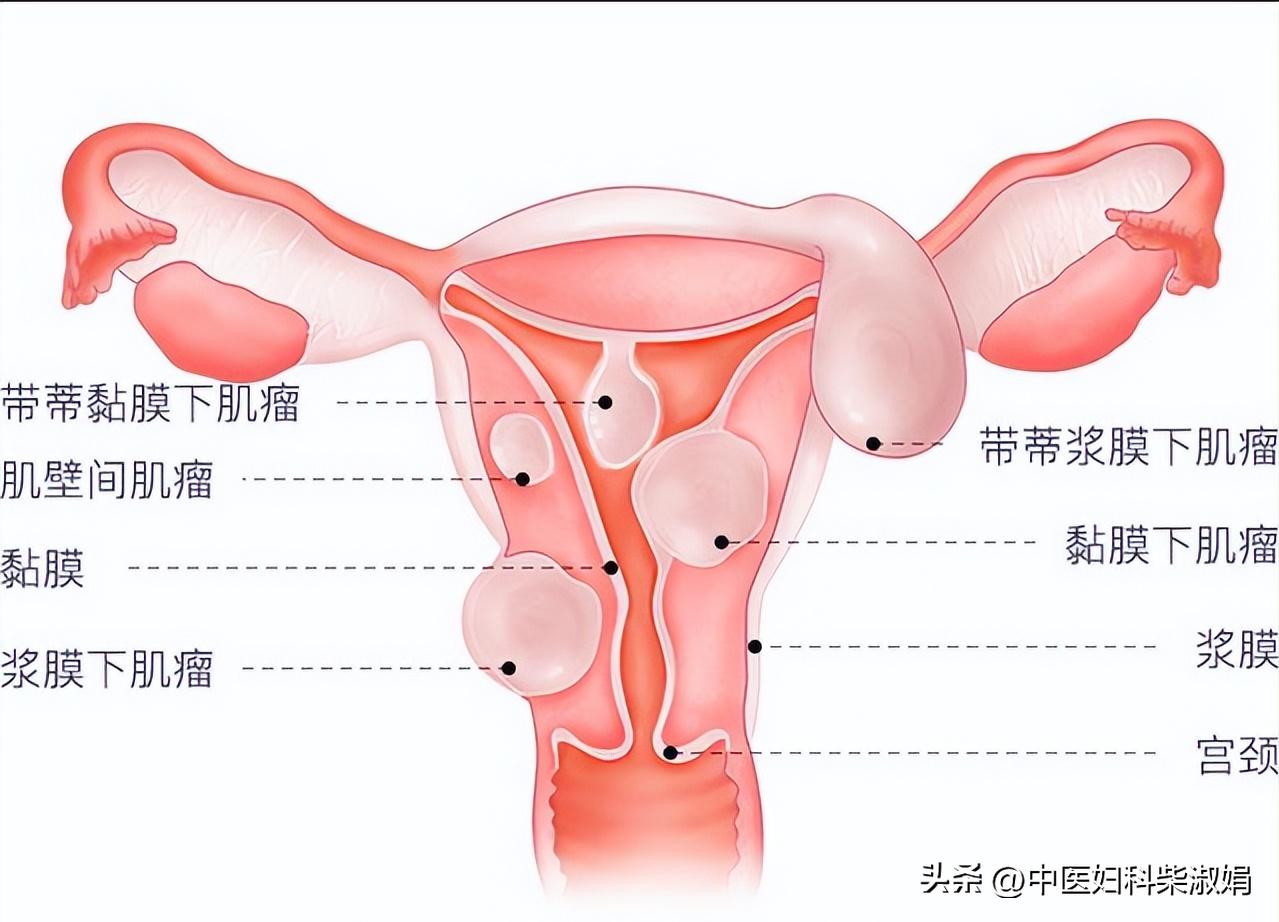 活血化瘀消除结节,中医如何散结祛瘀