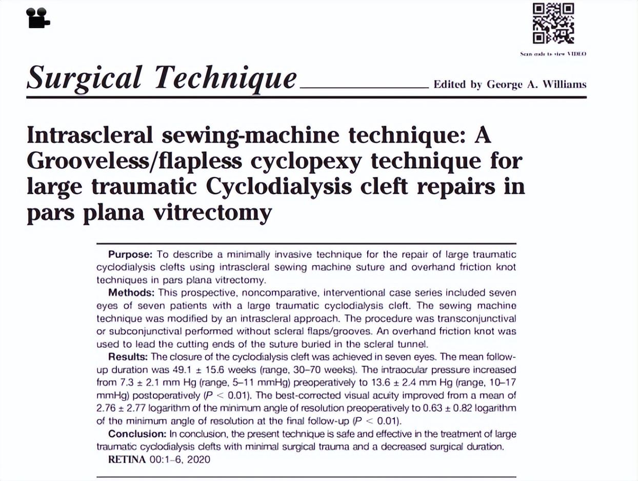 同济大学附属上海东方医院金海鹰教授：巩膜层间缝纫机技术要点
