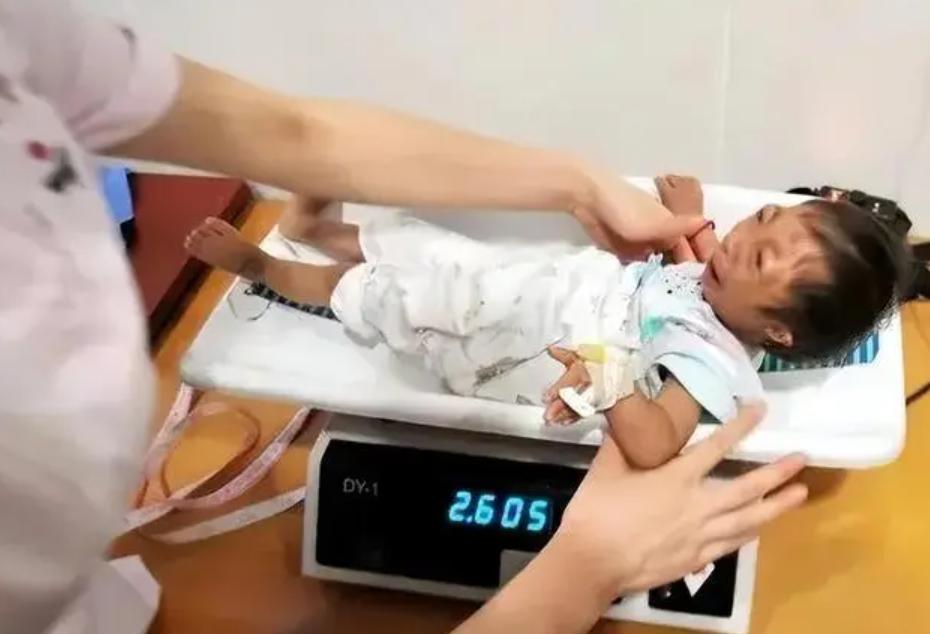 怀孕查出宝宝不健康,怀孕检测出婴儿肩膀不全