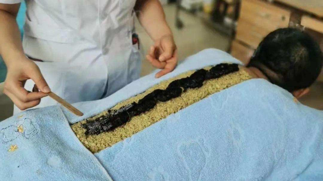 中医特色督脉灸，治疗多种慢性疾病！