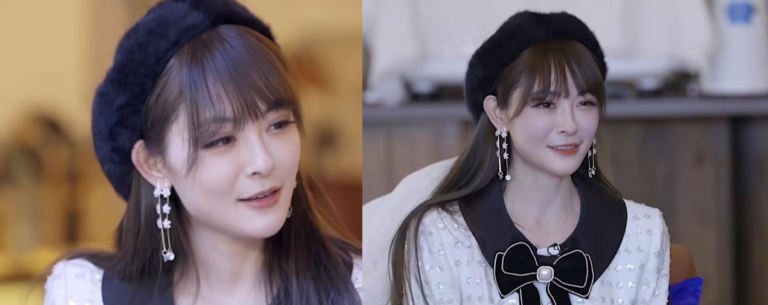 48岁整容阿姨,48岁阿姨整容完整版