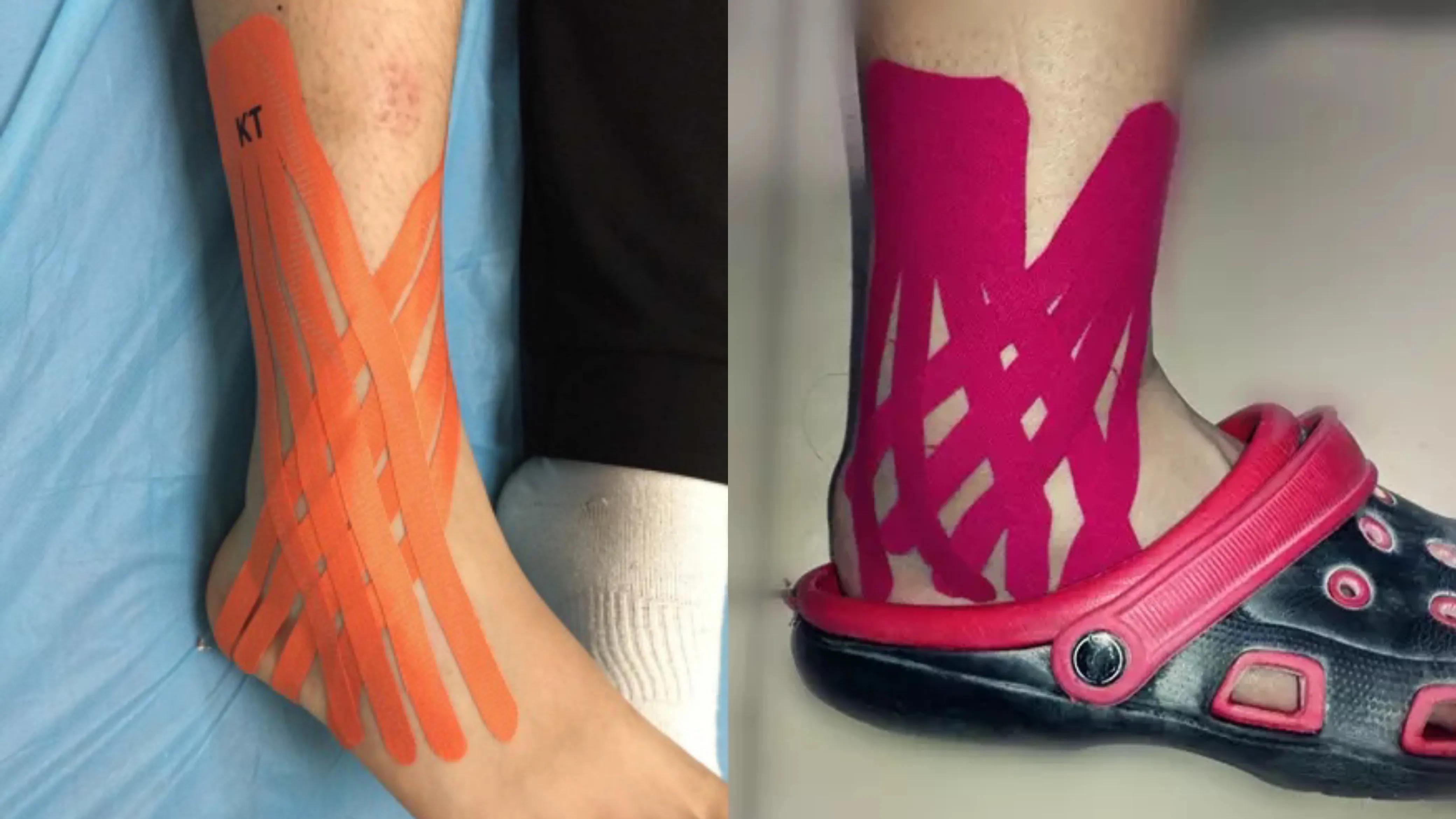 崴脚怎么知道复位了,崴脚别慌4招教你快速康复