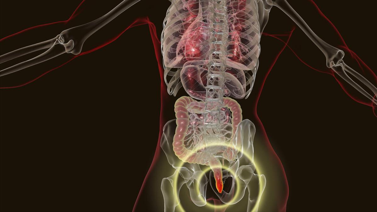 女性屁股中间毛太多,正常吗?能不能直接剃掉?医生劝你手下留情
