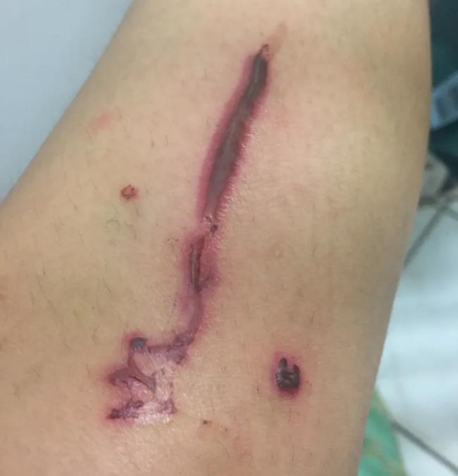 芒果很黏能水洗吗,新鲜芒果加盐可以防止氧化吗