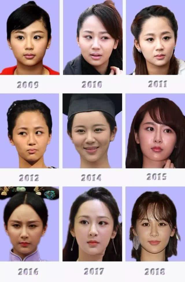 盘点整容失败惨不忍睹的30位女星,那些整容整失败的女明星