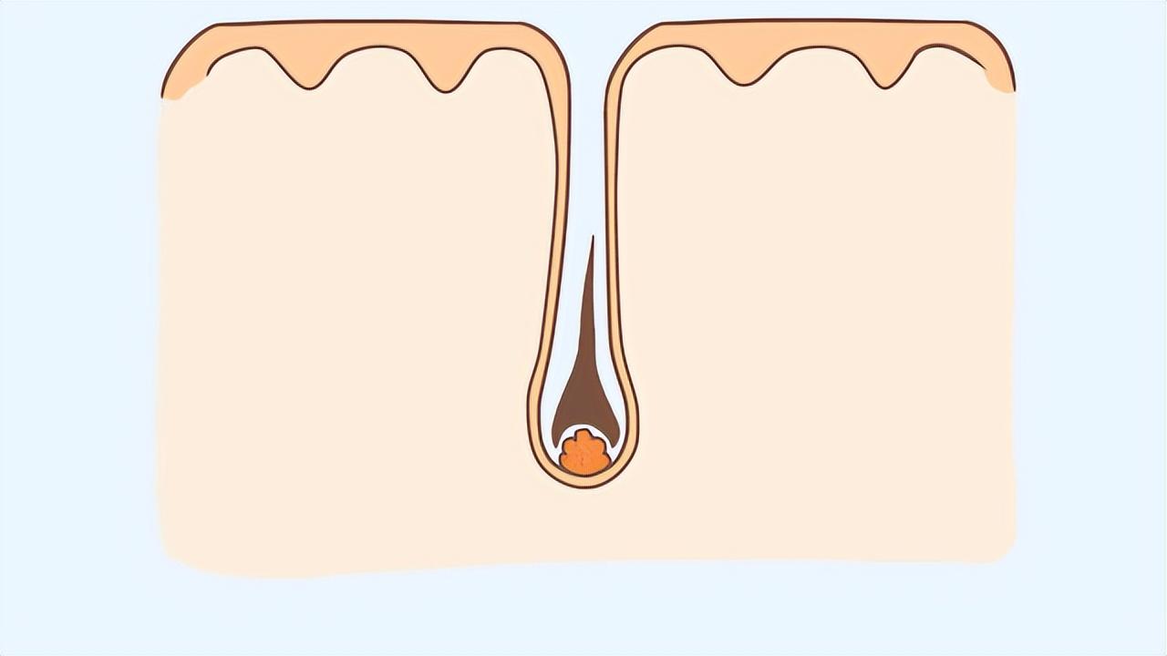 阴毛有什么用?要不要刮掉?由黑变白,意味着什么?男女都需了解