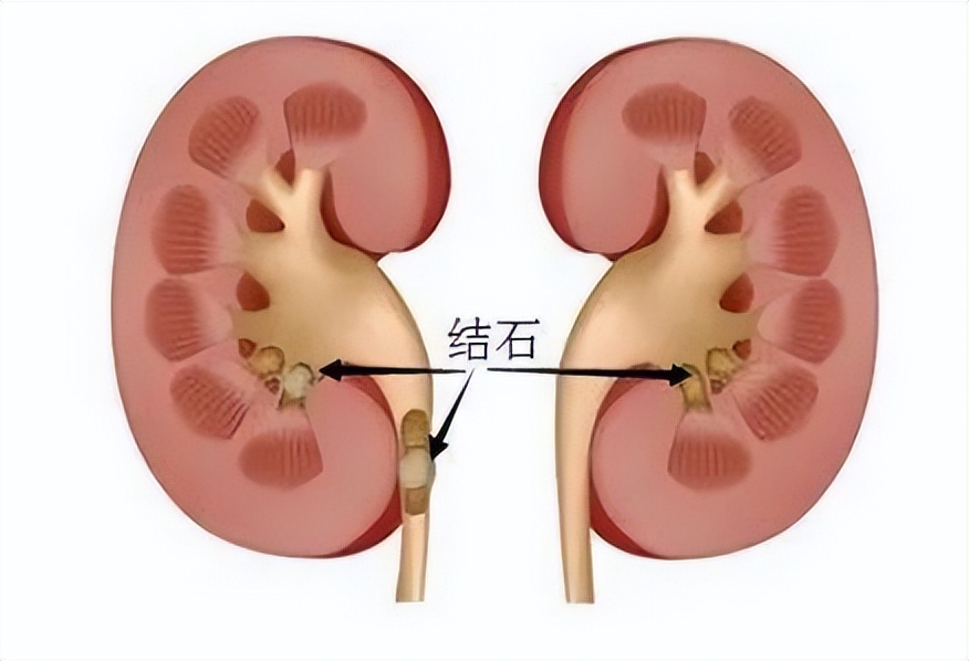 女人常喝豆浆粉的好处和坏处,儿童常喝豆浆对身体有好处吗