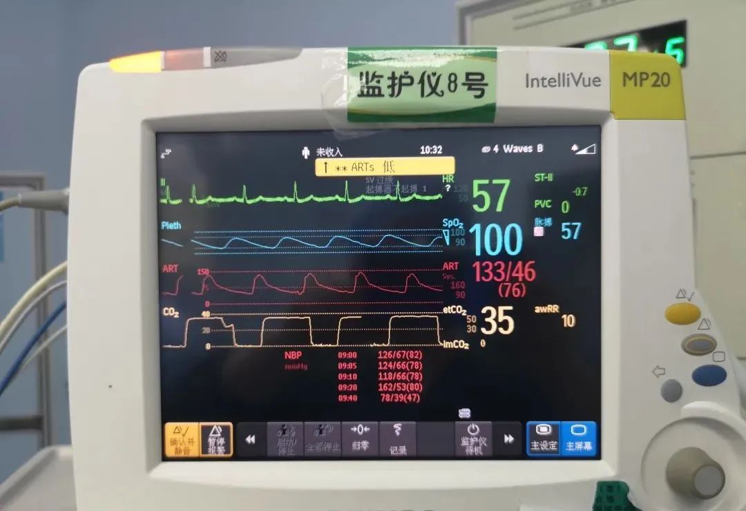 麻醉医生遇见三度房室传导阻滞怎么办？教你一招破解之术