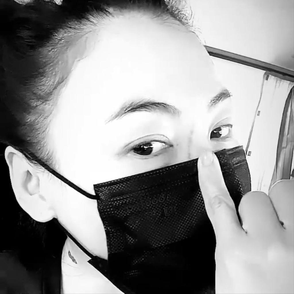 张柏芝被小狗咬到脸,张柏芝手臂伤疤被曝照片