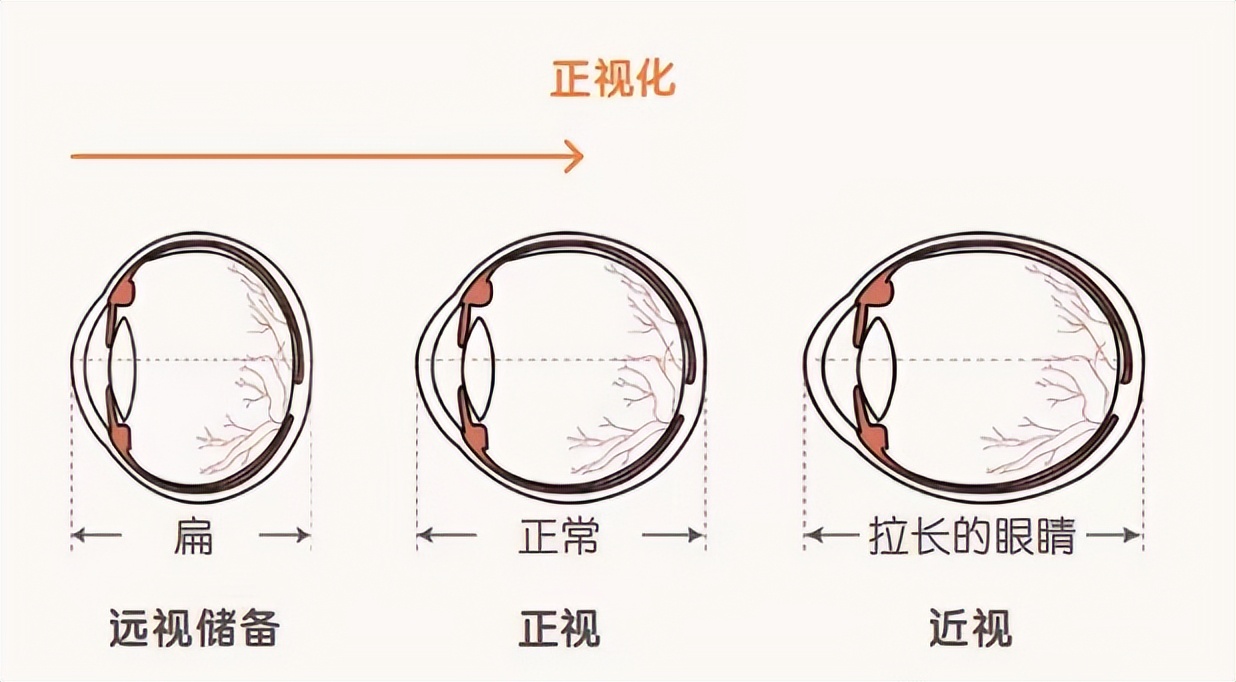 孩子学钢琴会伤眼睛吗,弹钢琴对孩子视力的影响