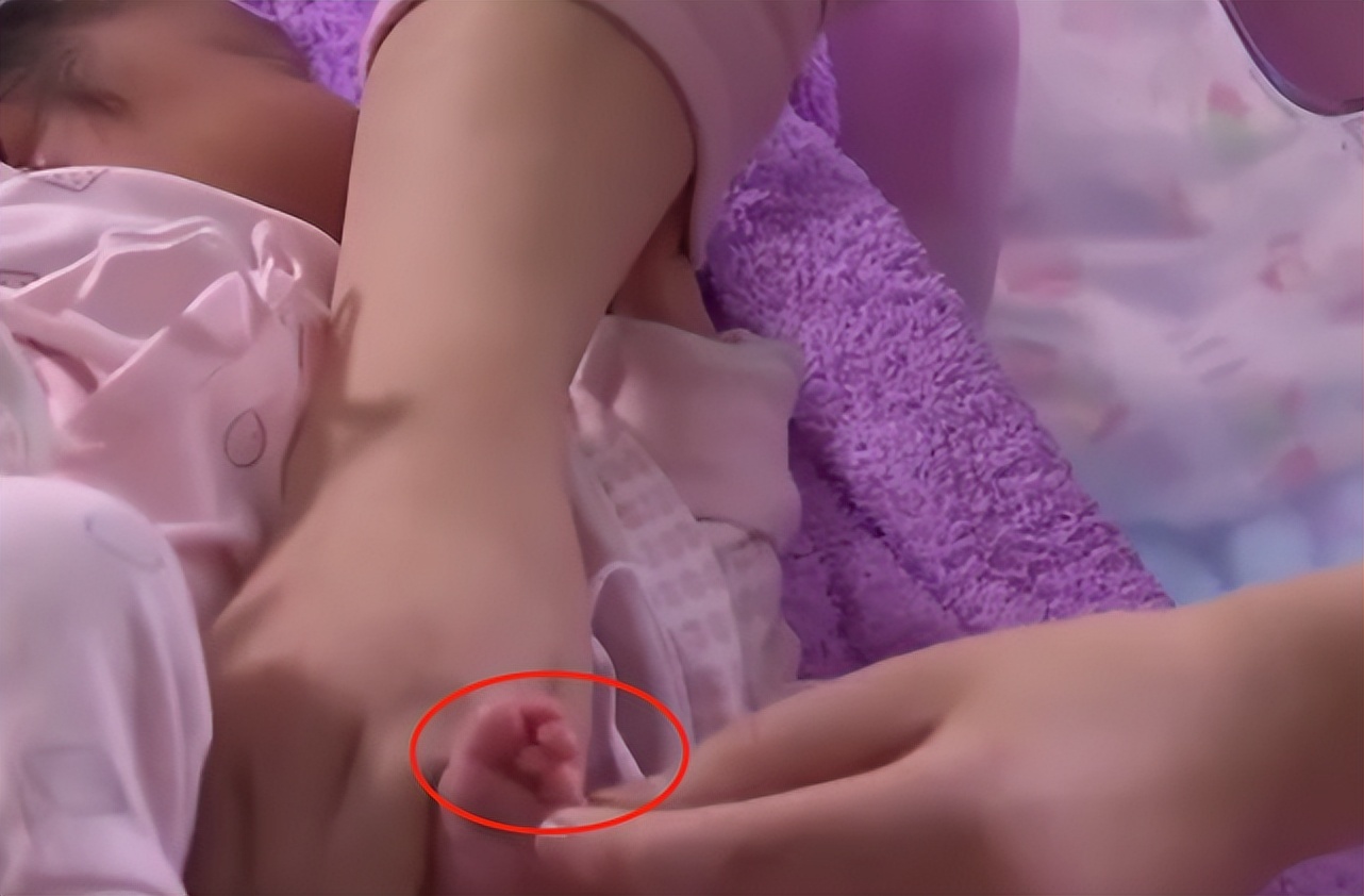 小孩出生少一只胳膊,婴儿出生只有一只胳膊