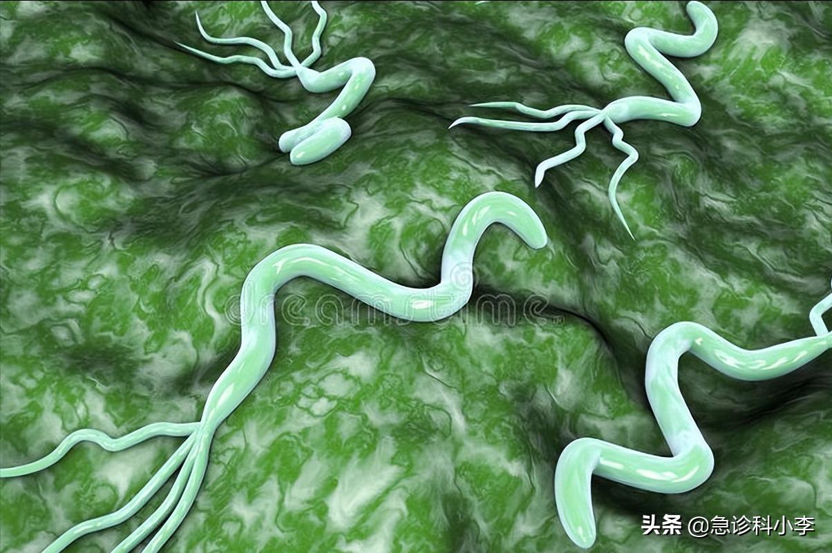 幽门螺杆菌是胃病的罪魁祸首吗,幽门螺杆菌一直治不好怎么办