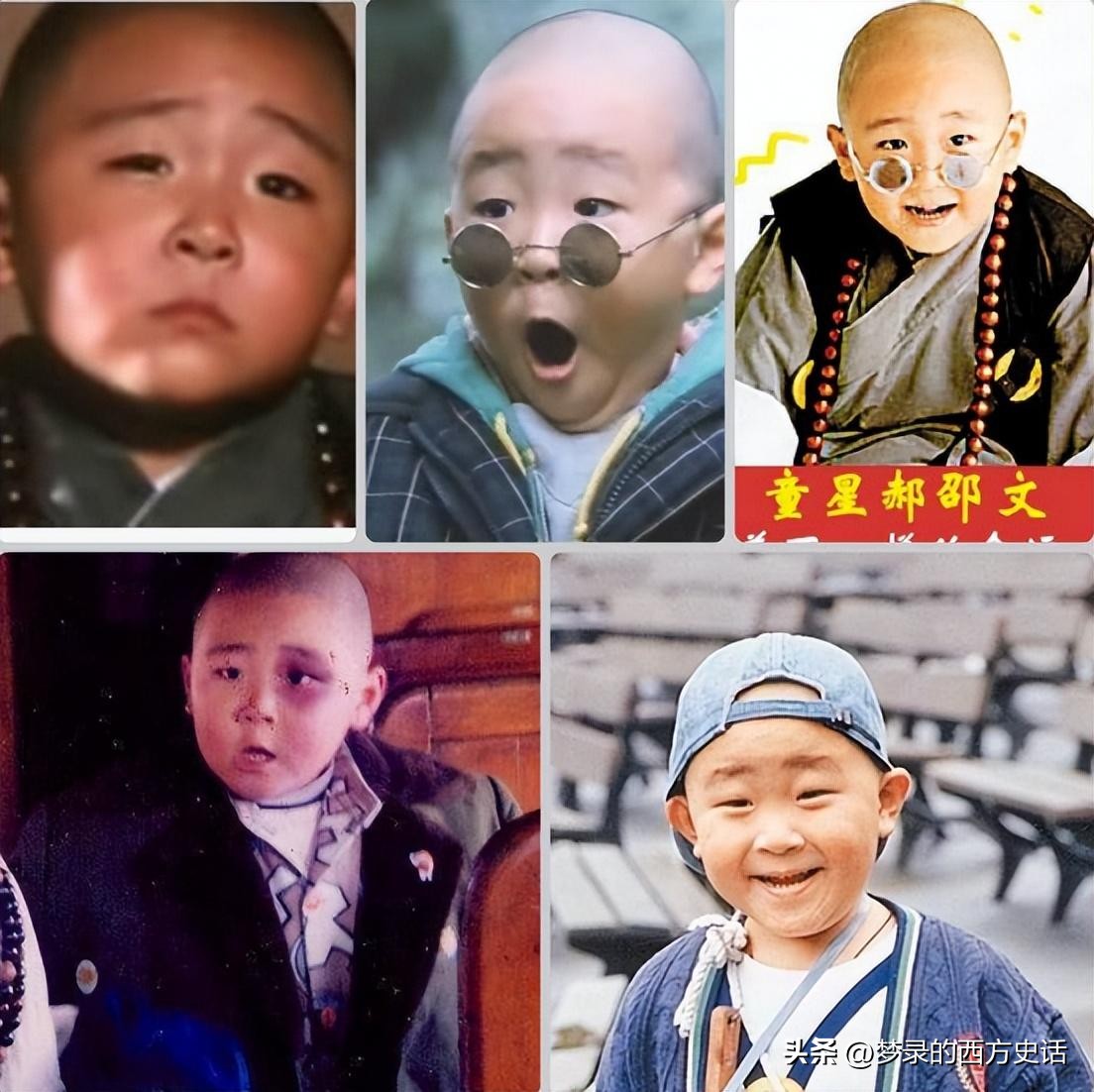 皮肤溃烂的童星,童星打促进生长激素后真实经历