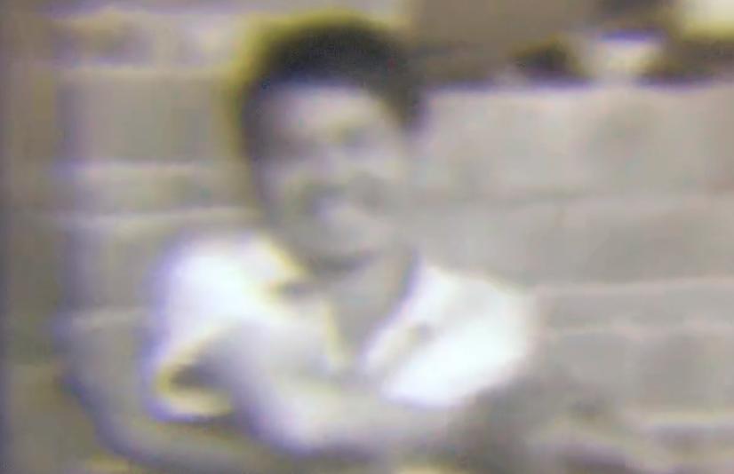 男子得了怪病身上长了树枝,男子患怪病手脚长得像树枝