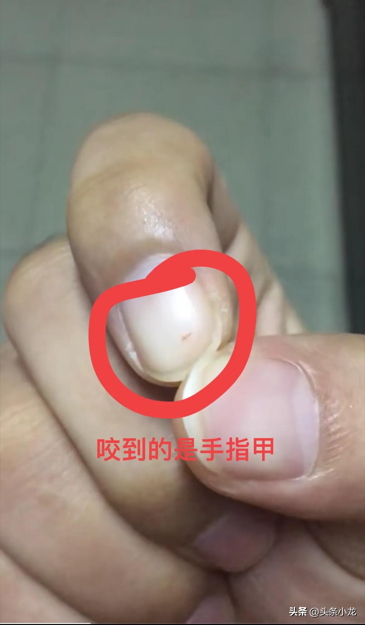 生平两次遇到比较坑的医院都是在东莞长安